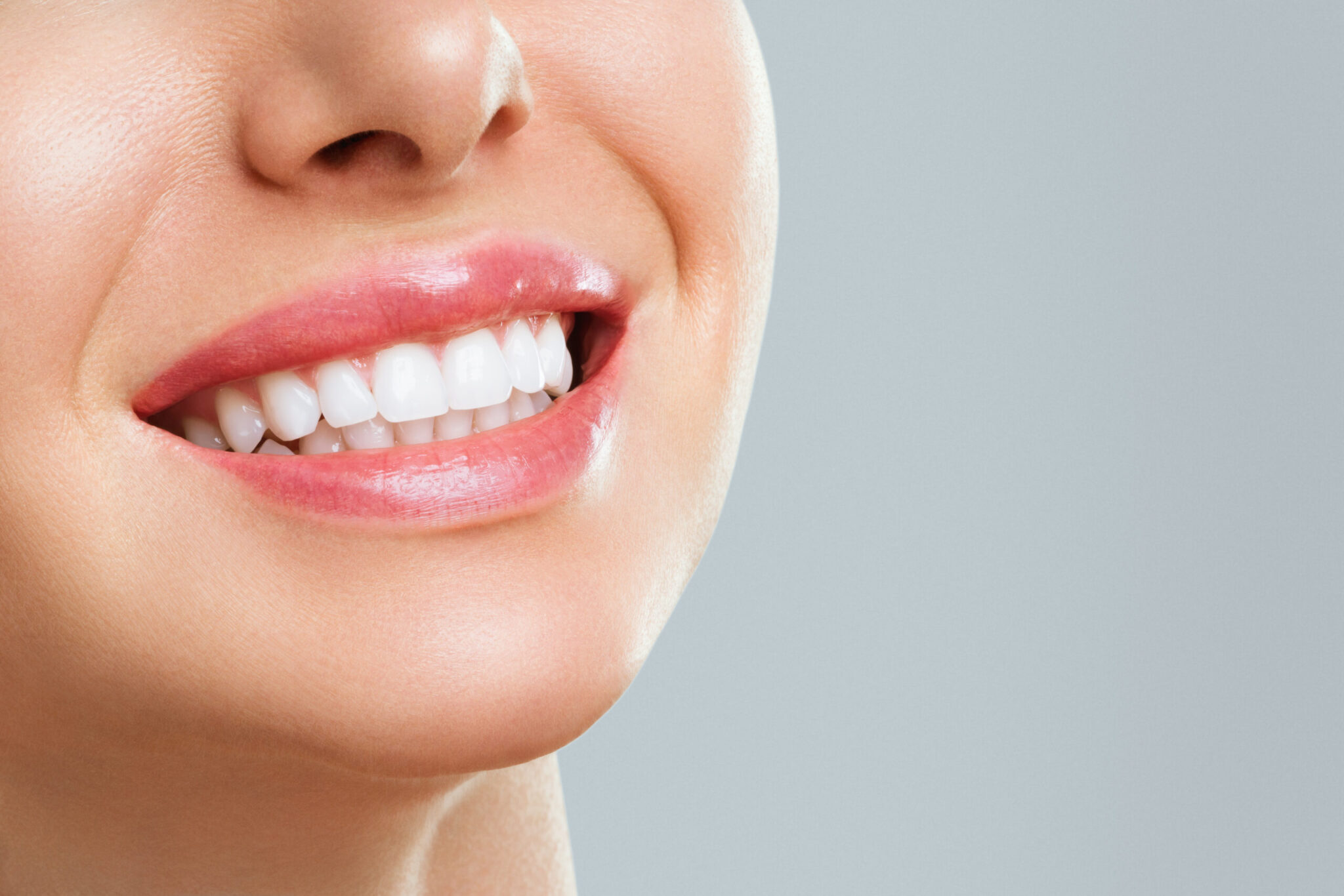 Quiero hacerme un blanqueamiento dental pero, ¿cuál es el mejor tratamiento?
